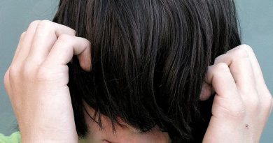 Un joven con una gran densidad de cabello